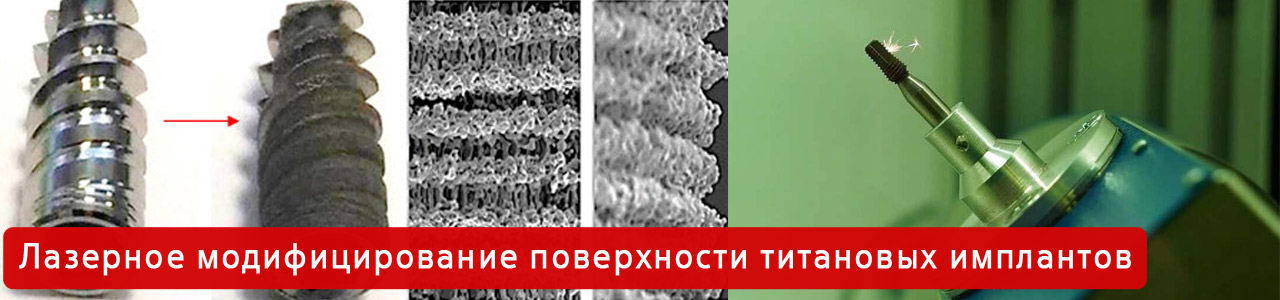 Лазерное модифицирование поверхности титановых имплантов
